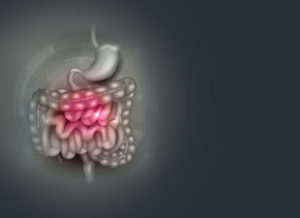 Acid Reflux Affects Nearly a Third of U.S. Adults Weekly