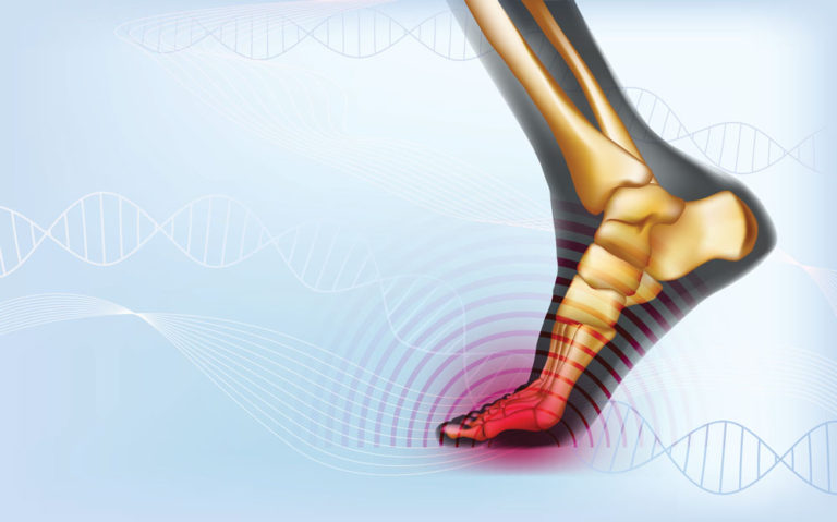 Bone and Joint Health