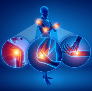 [Extra! Extra!] Targeting Your Audience for Bone and Joint Health